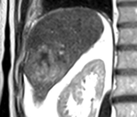 Image 1 Image 1