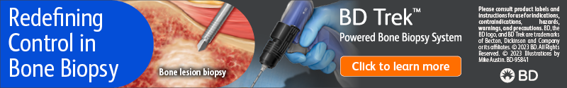 BD Trek Powered Bone Biopsy System
